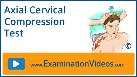 cervical compression test define|positive axial compression test.